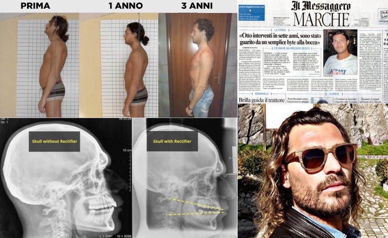 Archivní snímek k osobnímu zdravotnímu příběhu Simoneho Sinciniho
