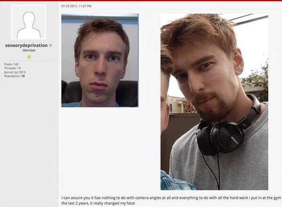 Výsledek korekce Bioblockem