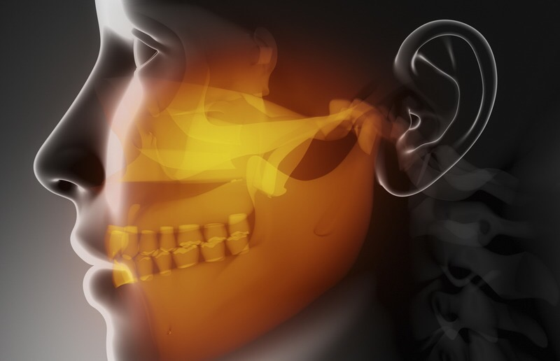 TMJ: penyakit bunglon